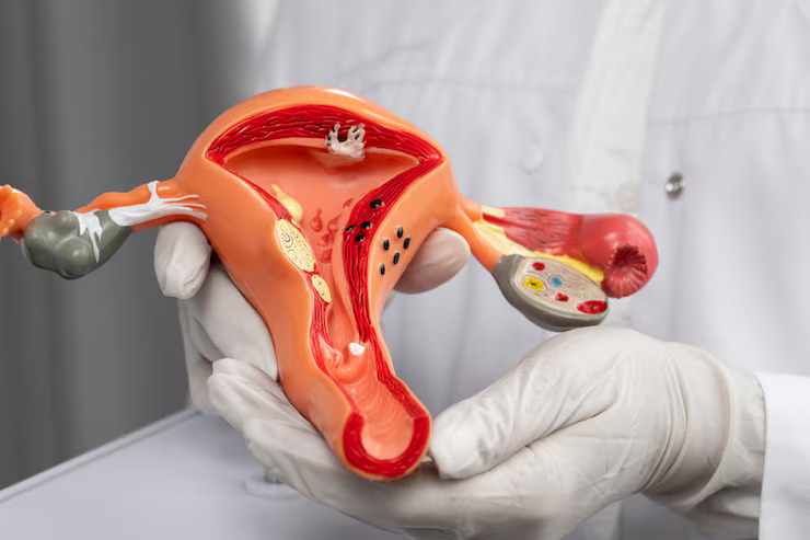 Breast Cancer Surgery