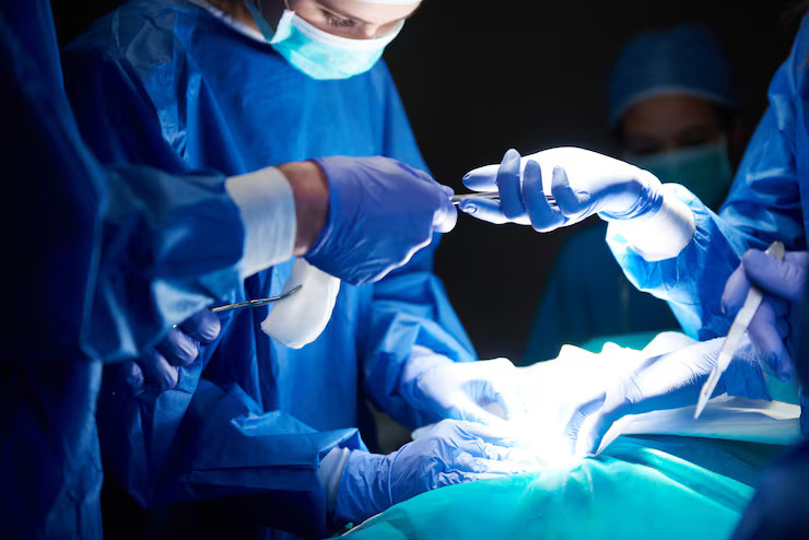 Breast Cancer Surgery